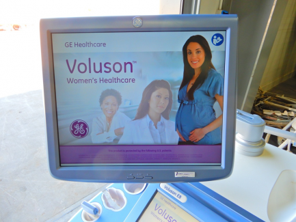 Zdjęcie przedmiotu: Ultrasound apparatus GE Healthcare Austria GmbH & Co OG Voluson E8