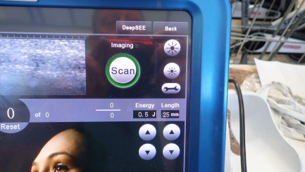 Zdjęcie przedmiotu: A device for aesthetic medicine HI-Sonix