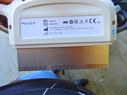 Zdjęcie przedmiotu: GE Ultrasound Korea ultrasound machine. Ltd. LOGIQ S8 R1 is R2 UPG