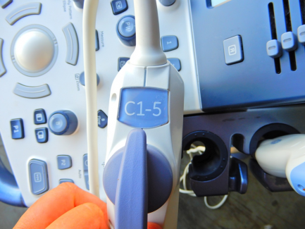 Zdjęcie przedmiotu: GE Ultrasound Korea ultrasound machine. Ltd. LOGIQ S8 R1 is R2 UPG