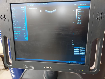 Zdjęcie przedmiotu: Ultrasound machine SHENZHEN MINDRAY BIO-MEDICAL ELECTRONICS CO. LTD. DC-30