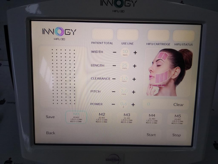 Zdjęcie przedmiotu: Hifu Innogy 3D medical device