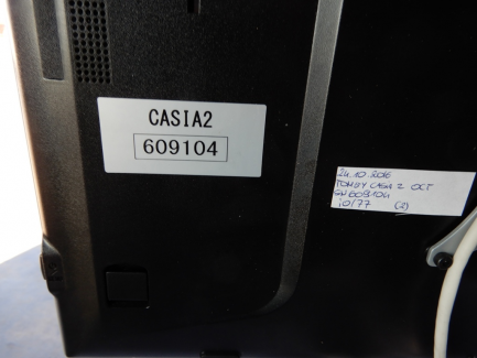 Zdjęcie przedmiotu: Optical tomograph Cornea Anterior Segment Oct