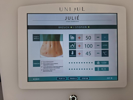 Zdjęcie przedmiotu: Urządzenie kosmetyczne do karboksyterapii ELZET UNIQUE JULIE