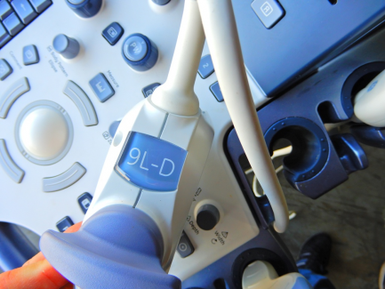 Zdjęcie przedmiotu: GE Ultrasound Korea ultrasound machine. Ltd. LOGIQ S8 R1 is R2 UPG