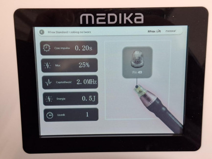 Zdjęcie przedmiotu: MEDICA RFRAX cosmetic device designed for face and body lifting used in aesthetic medicine treatments